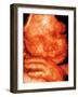 Ultrasound of Foetus' Face-Bernard Benoit-Framed Photographic Print