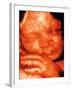 Ultrasound of Foetus' Face-Bernard Benoit-Framed Photographic Print