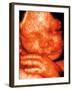 Ultrasound of Foetus' Face-Bernard Benoit-Framed Photographic Print