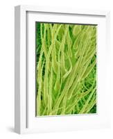 Underside of a Stinging Nettle Leaf-Micro Discovery-Framed Photographic Print