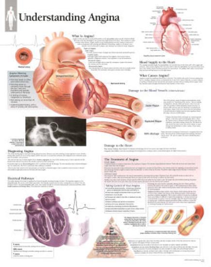 Poster, , large