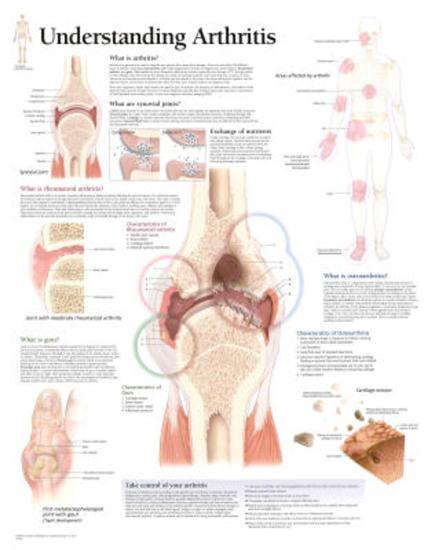 Poster, , large