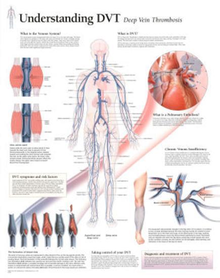Poster, , large