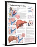 Understanding Hepatitis Educational Chart Poster-null-Framed Poster