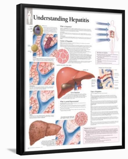 Understanding Hepatitis Educational Chart Poster-null-Framed Poster