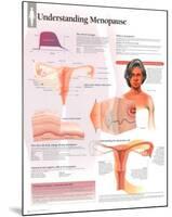 Understanding Menopause Educational Anatomy Poster-null-Mounted Poster