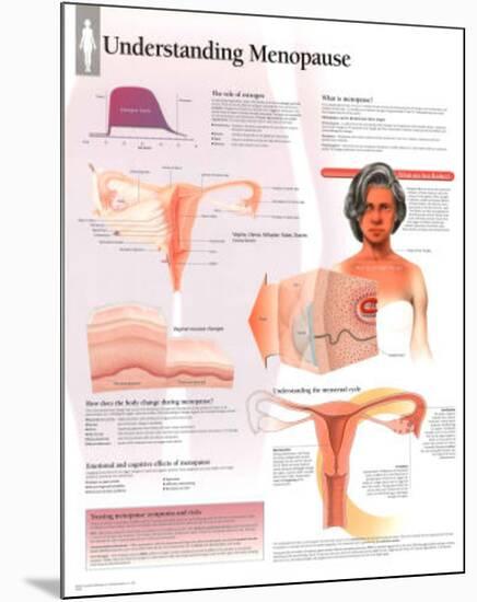 Understanding Menopause Educational Anatomy Poster-null-Mounted Poster