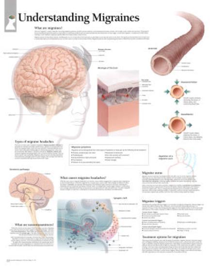 Poster, , large