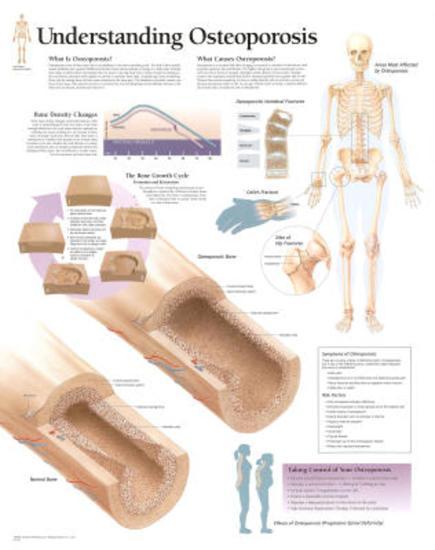 Poster, , large