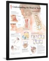 Understanding The Head & Neck-null-Lamina Framed Poster