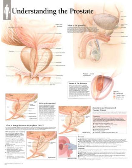 Poster, , large
