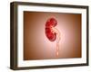 Ureterovesical Junction (Uvj) in the Kidney-null-Framed Art Print