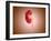 Ureterovesical Junction (Uvj) in the Kidney-null-Framed Art Print
