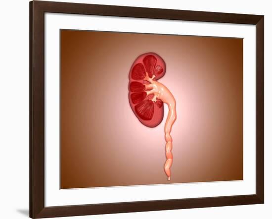 Ureterovesical Junction (Uvj) in the Kidney-null-Framed Art Print