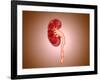 Ureterovesical Junction (Uvj) in the Kidney-null-Framed Art Print