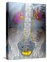 Urinary System, X-ray-Du Cane Medical-Stretched Canvas