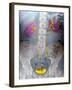 Urinary System, X-ray-Du Cane Medical-Framed Photographic Print