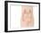 Urostomy Procedure, Artwork-Peter Gardiner-Framed Photographic Print