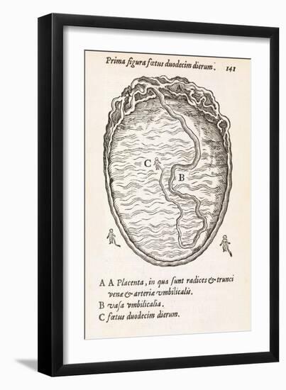 Uterus And Embryo, 16th Century-Middle Temple Library-Framed Photographic Print