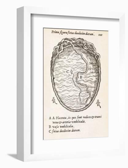 Uterus And Embryo, 16th Century-Middle Temple Library-Framed Photographic Print