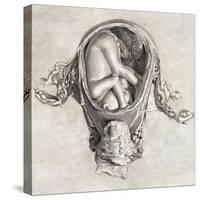 Uterus with Fetus, Illustration, 1774-Science Source-Stretched Canvas