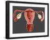 Uterus-Gwen Shockey-Framed Giclee Print