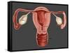 Uterus-Gwen Shockey-Framed Stretched Canvas