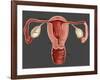 Uterus-Gwen Shockey-Framed Giclee Print