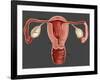 Uterus-Gwen Shockey-Framed Giclee Print