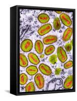 Vaccinia Viruses, TEM-Dr. Klaus Boller-Framed Stretched Canvas