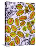 Vaccinia Viruses, TEM-Dr. Klaus Boller-Stretched Canvas
