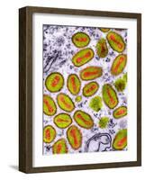 Vaccinia Viruses, TEM-Dr. Klaus Boller-Framed Photographic Print