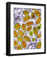 Vaccinia Viruses, TEM-Dr. Klaus Boller-Framed Photographic Print