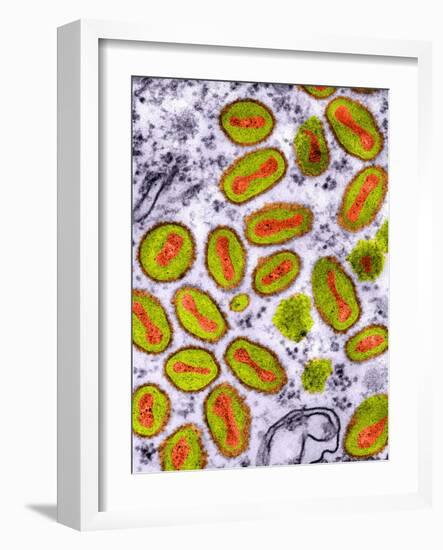 Vaccinia Viruses, TEM-Dr. Klaus Boller-Framed Photographic Print