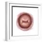 Vaginal View of Cervix-null-Framed Art Print