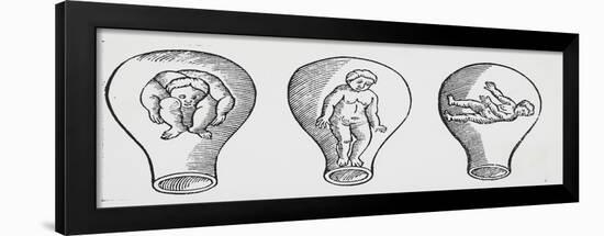 Various Positions of Fetus in Utero from Rosegarden for Pregnant Women and Midwives-null-Framed Giclee Print