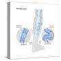 Variscose Veins-Encyclopaedia Britannica-Stretched Canvas