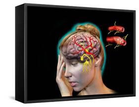Vascular Causes of Headaches-Jose Antonio-Framed Stretched Canvas