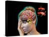 Vascular Causes of Headaches-Jose Antonio-Stretched Canvas