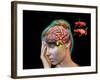 Vascular Causes of Headaches-Jose Antonio-Framed Photographic Print