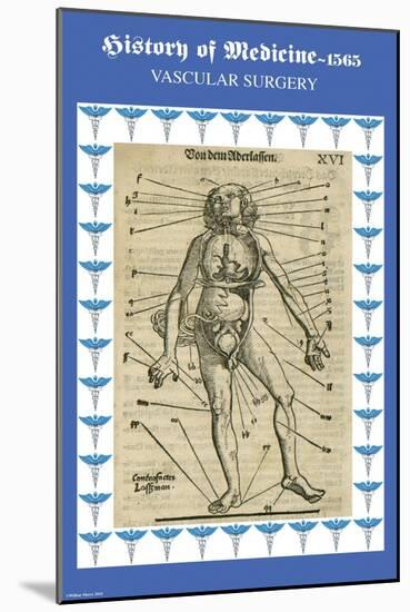 Vascular Surgery-Paracelsus-Mounted Art Print