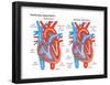 Ventricular Septal Defect-Encyclopaedia Britannica-Framed Poster