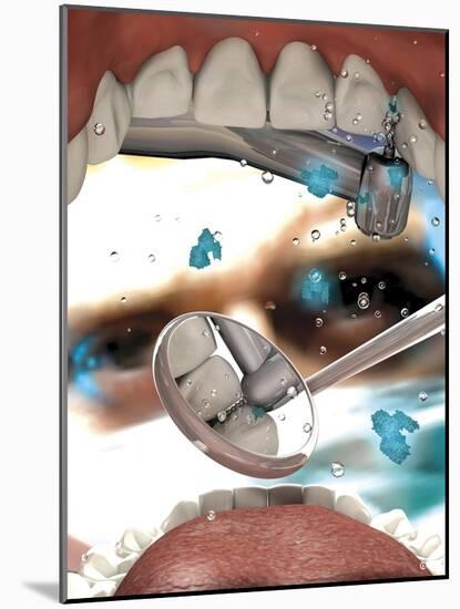 View Looking from Inside the Mouth While at the Dentist-null-Mounted Art Print