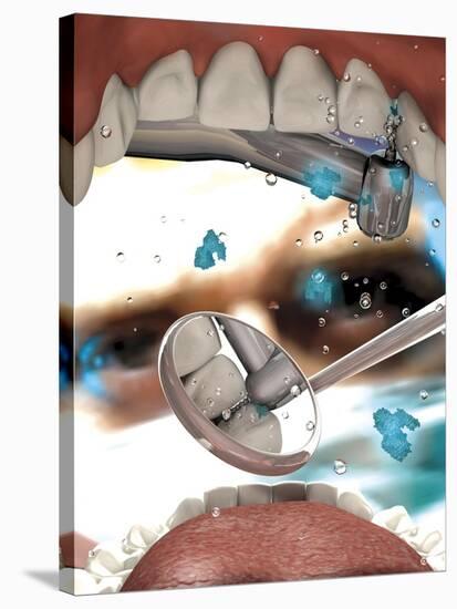 View Looking from Inside the Mouth While at the Dentist-null-Stretched Canvas