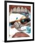 View Looking from Inside the Mouth While at the Dentist-null-Framed Art Print