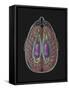 View of Limbic System as Seen from Directly Above the Head-null-Framed Stretched Canvas