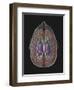 View of Limbic System as Seen from Directly Above the Head-null-Framed Art Print