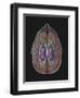View of Limbic System as Seen from Directly Above the Head-null-Framed Art Print