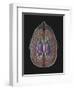 View of Limbic System as Seen from Directly Above the Head-null-Framed Art Print