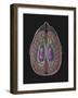 View of Limbic System as Seen from Directly Above the Head-null-Framed Art Print